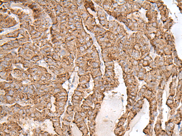 Rabbit Polyclonal Antibody to AP1S1