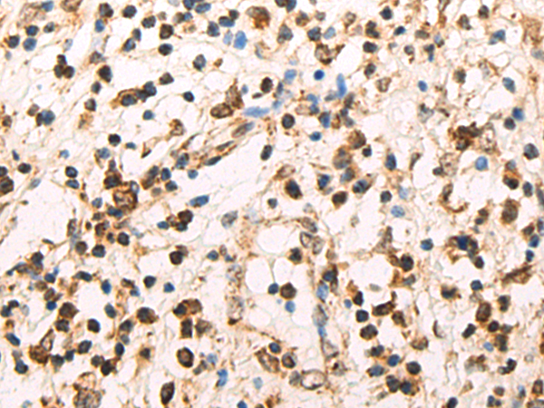 Rabbit Polyclonal Antibody to POLR2D