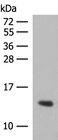 Rabbit Polyclonal Antibody to HBG1/HBG2