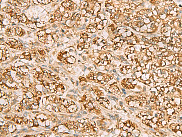 Rabbit Polyclonal Antibody to MTAP