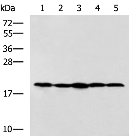 Rabbit Polyclonal Antibody to RPS11