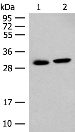 Rabbit Polyclonal Antibody to GLYAT