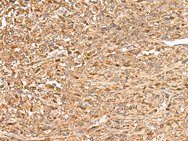 Rabbit Polyclonal Antibody to ZC3H7A