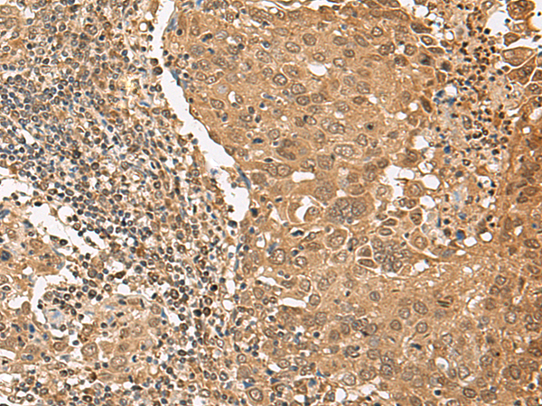 Rabbit Polyclonal Antibody to TIPRL
