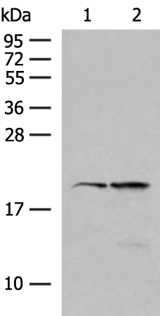 Rabbit Polyclonal Antibody to RNF5