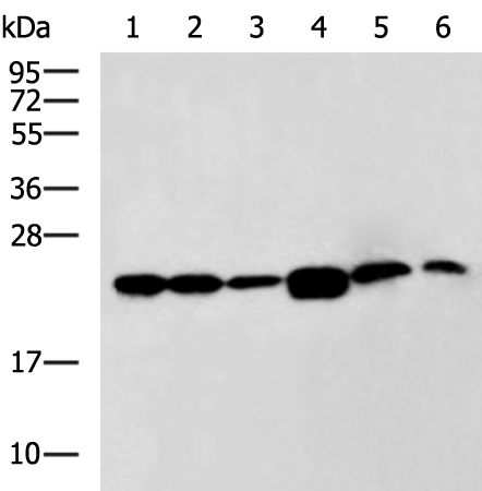 Rabbit Polyclonal Antibody to RPL17