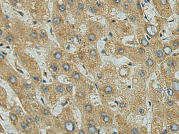 Rabbit Polyclonal Antibody to USP53