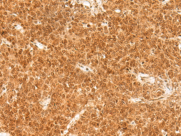 Rabbit Polyclonal Antibody to TOR1A
