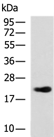 Rabbit Polyclonal Antibody to TMA16