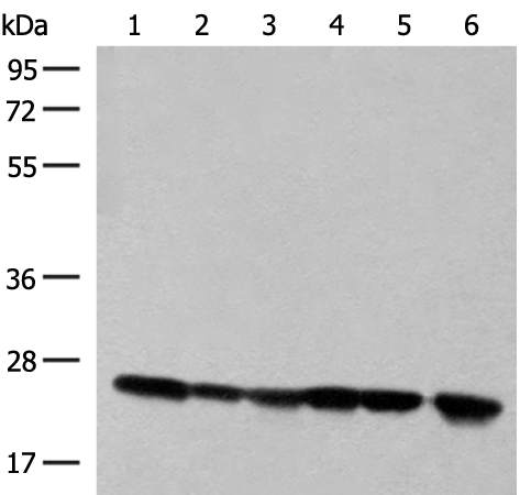Rabbit Polyclonal Antibody to DTYMK