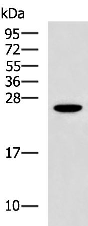 Rabbit Polyclonal Antibody to GSTZ1