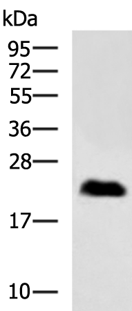 Rabbit Polyclonal Antibody to HPRT1