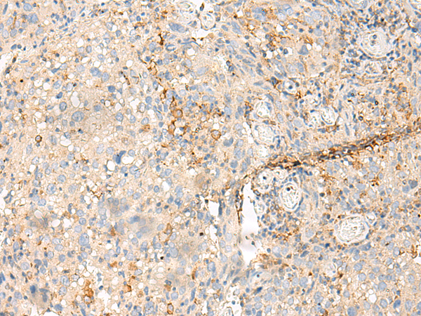 Rabbit Polyclonal Antibody to MDFI