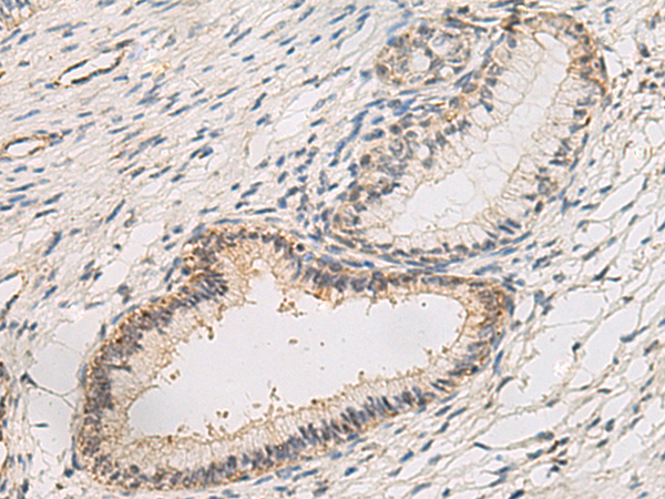 Rabbit Polyclonal Antibody to NIPSNAP3A