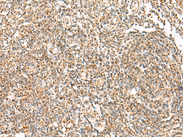 Rabbit Polyclonal Antibody to ORC4