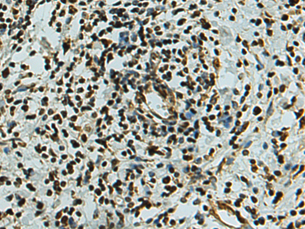 Rabbit Polyclonal Antibody to FUBP3