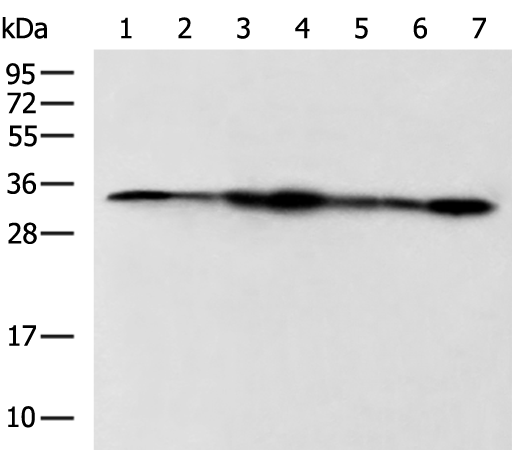 Rabbit Polyclonal Antibody to PSMA1