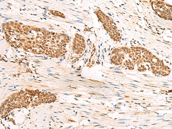 Rabbit Polyclonal Antibody to HUS1