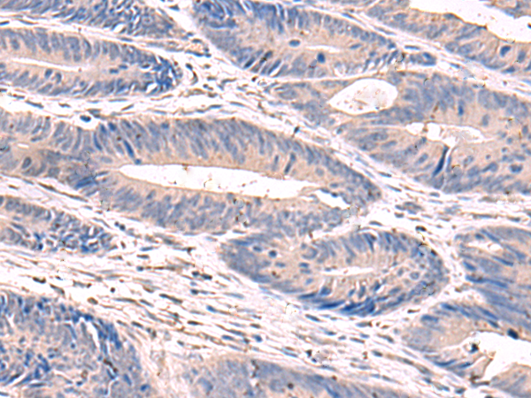 Rabbit Polyclonal Antibody to GKAP1