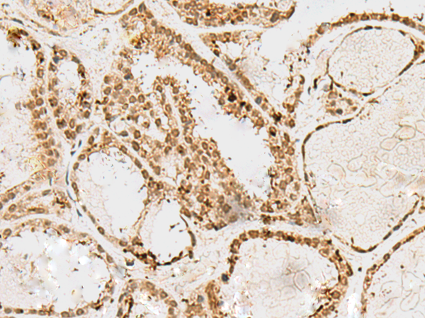 Rabbit Polyclonal Antibody to SNAPC1