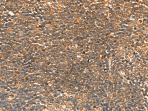 Rabbit Polyclonal Antibody to STK32C