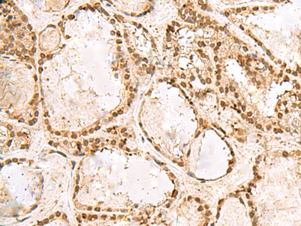 Rabbit Polyclonal Antibody to KRR1