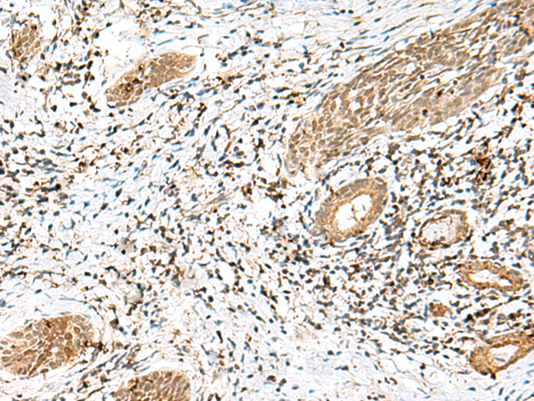 Rabbit Polyclonal Antibody to LPXN