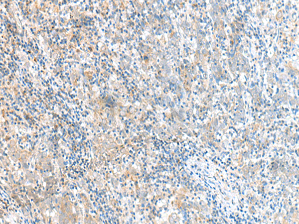Rabbit Polyclonal Antibody to RMND5A