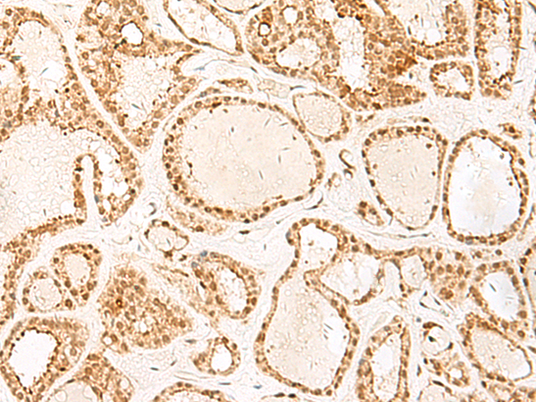 Rabbit Polyclonal Antibody to PSPC1