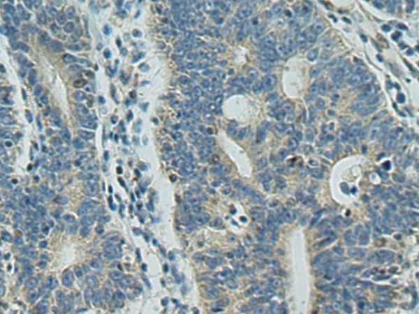 Rabbit Polyclonal Antibody to EIF2B3