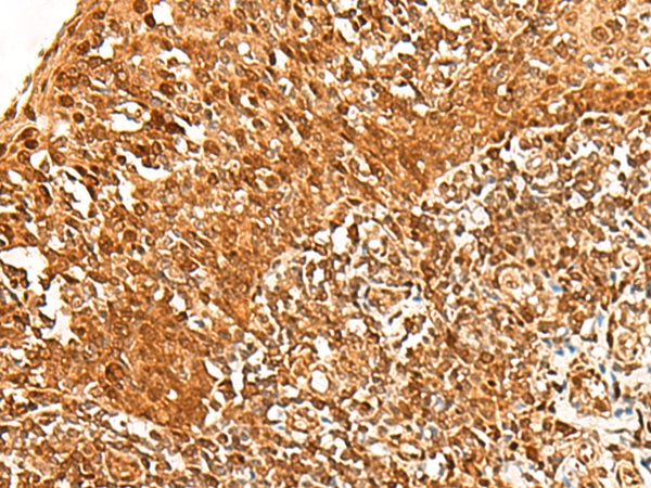 Rabbit Polyclonal Antibody to ADRM1