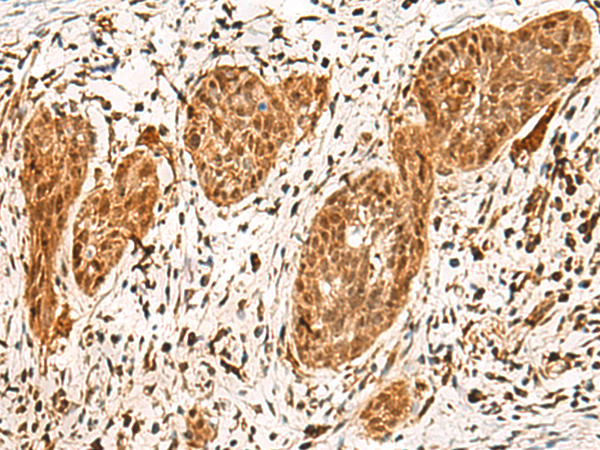 Rabbit Polyclonal Antibody to POLR1E