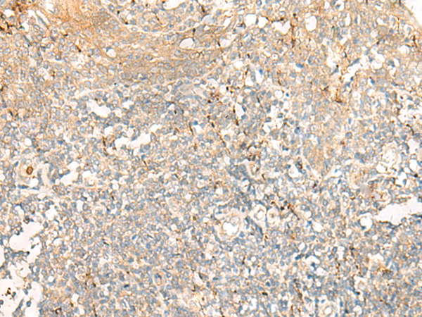Rabbit Polyclonal Antibody to GCAT