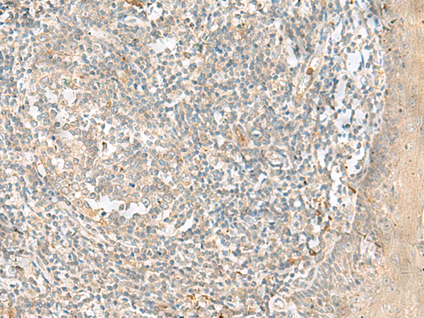 Rabbit Polyclonal Antibody to TTLL1