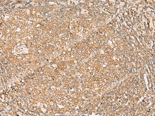 Rabbit Polyclonal Antibody to FNTB