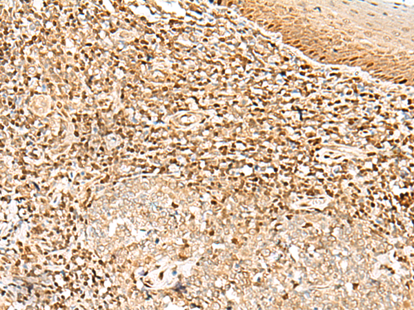Rabbit Polyclonal Antibody to DNPEP