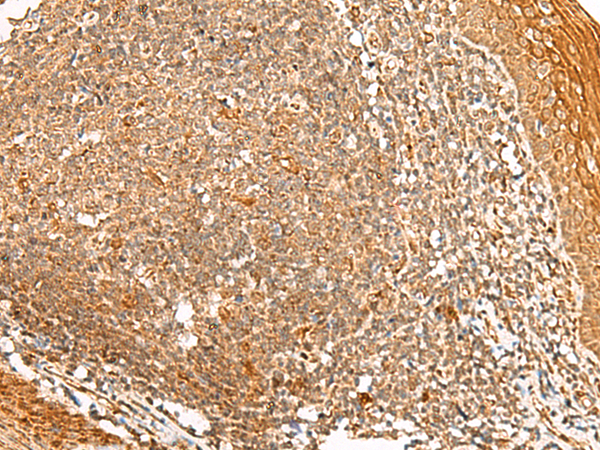 Rabbit Polyclonal Antibody to PPOX