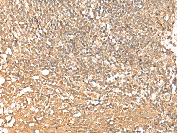 Rabbit Polyclonal Antibody to PWP1