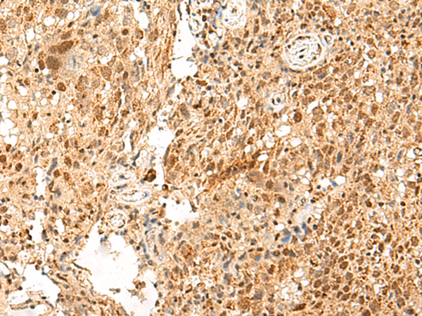 Rabbit Polyclonal Antibody to PAF1