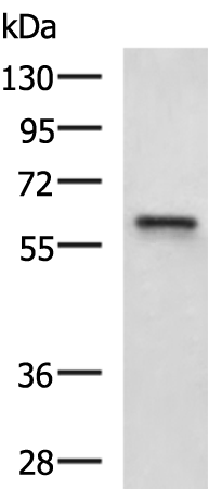 Rabbit Polyclonal Antibody to LPCAT2