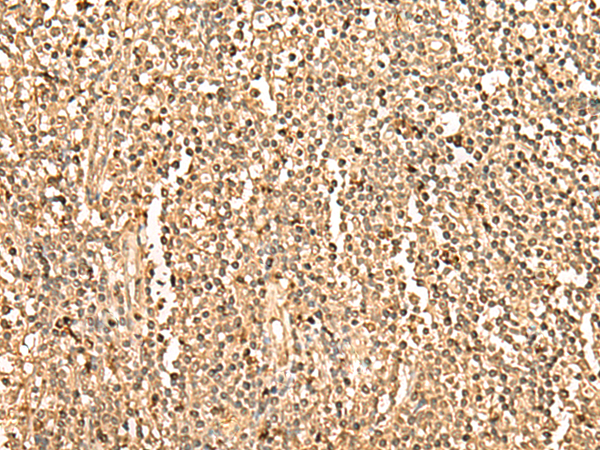 Rabbit Polyclonal Antibody to PPM1G