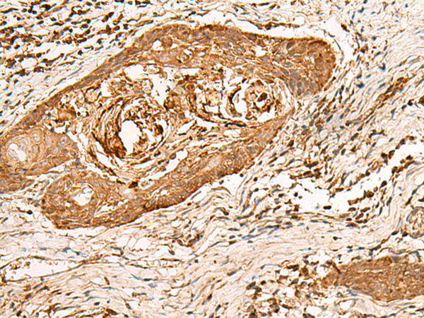 Rabbit Polyclonal Antibody to HIRIP3