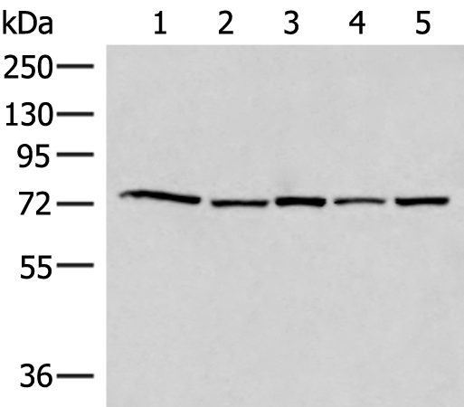 Rabbit Polyclonal Antibody to ATMIN