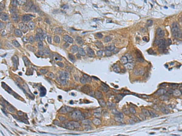 Rabbit Polyclonal Antibody to EXT1