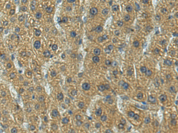 Rabbit Polyclonal Antibody to CFAP47