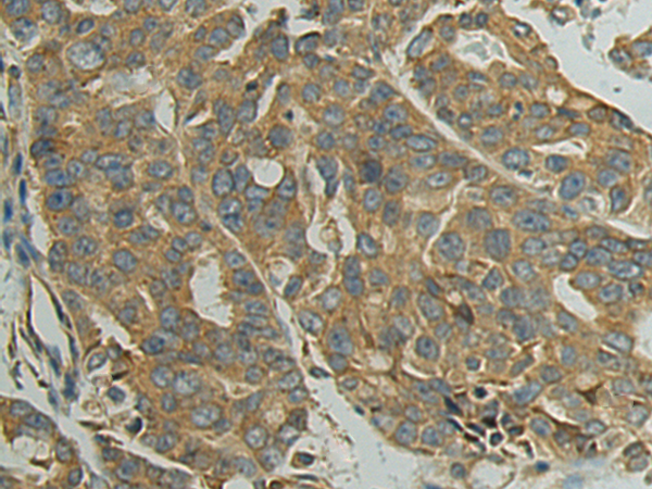 Rabbit Polyclonal Antibody to PIGQ