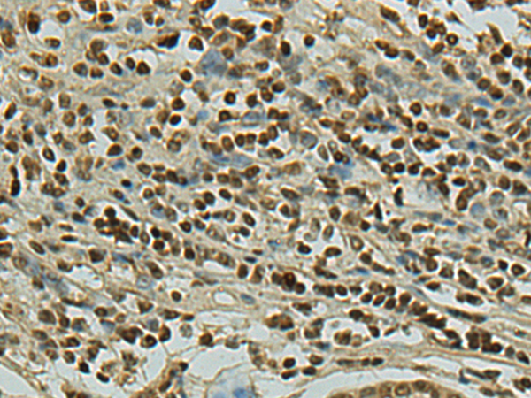 Rabbit Polyclonal Antibody to FBH1