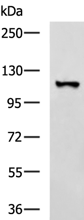 Rabbit Polyclonal Antibody to TTC16