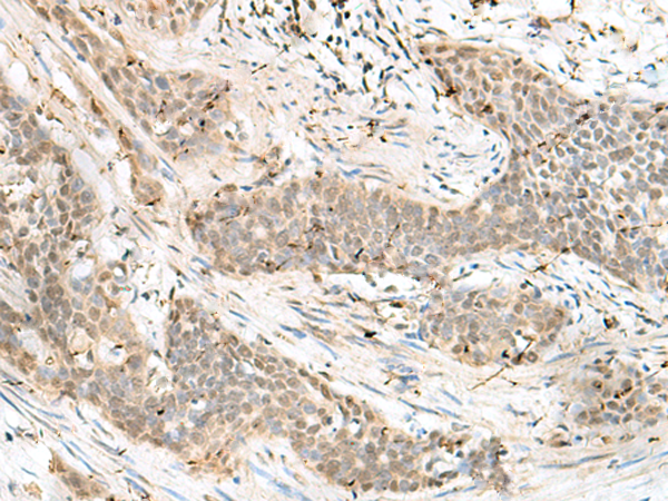 Rabbit Polyclonal Antibody to LIG4