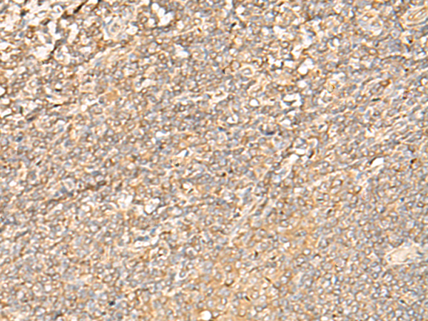 Rabbit Polyclonal Antibody to EIF3C